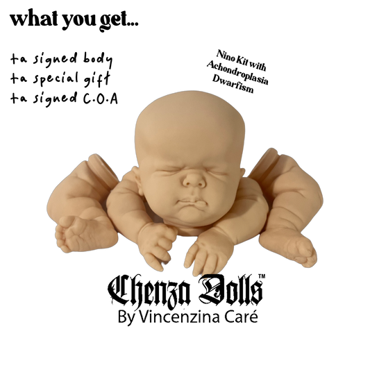 Sold out-Nino doll Kit with Achondroplasia Dwarfism