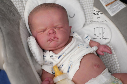 Sold out-Nino doll Kit with Achondroplasia Dwarfism